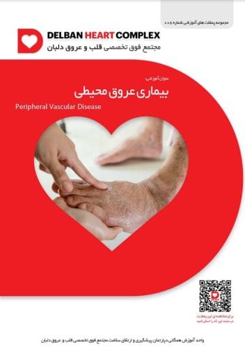 بیماری عروق محیطی