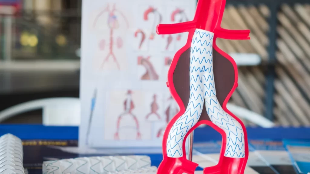 EVAR (Endovascular Aneurysm Repair) یا ترمیم آنوریسم اندوواسکولار آئورت شکمی