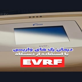 درمان واریس پا با لیزر