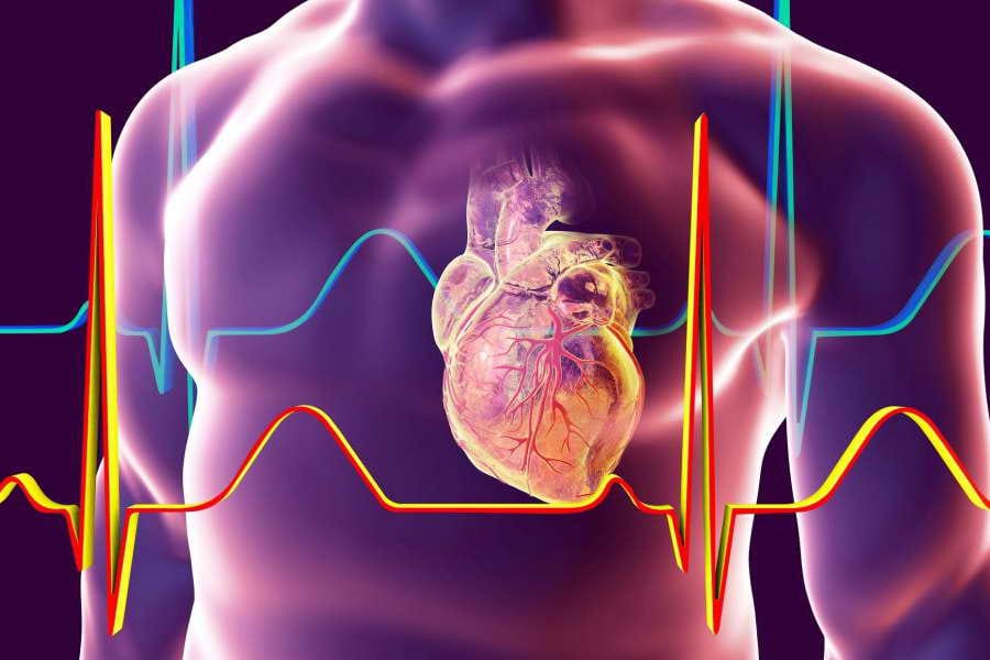 آریتمی های قلبی