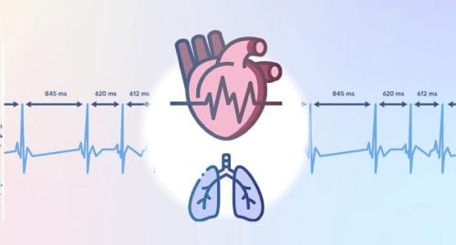 برادی آریتمی های قلبی