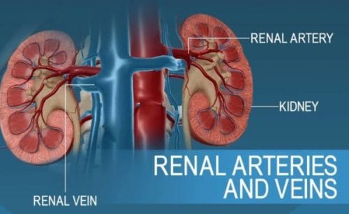 تنگی شریان کلیه عامل فشارخون بالا