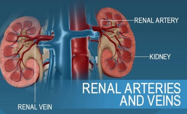 تنگی شریان کلیه عامل فشارخون بالا