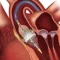 Sapien 3 TAVR Edwards Lifesciences horizontal